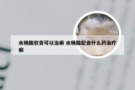 水杨酸软膏可以治癣 水杨酸配合什么药治疗癣