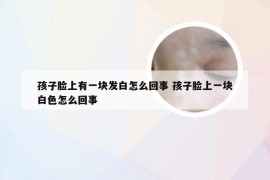 孩子脸上有一块发白怎么回事 孩子脸上一块白色怎么回事