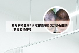 复方多粘菌素B软膏治银屑病 复方多粘菌素b软膏能祛疤吗