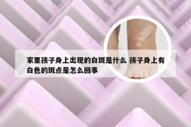 家里孩子身上出现的白斑是什么 孩子身上有白色的斑点是怎么回事