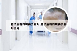 脖子后有白斑要去看吗 脖子后有白斑要去看吗图片