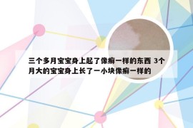 三个多月宝宝身上起了像癣一样的东西 3个月大的宝宝身上长了一小块像癣一样的