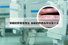 体癣的种类及特征 体癣的种类及特征是什么