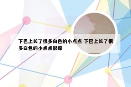 下巴上长了很多白色的小点点 下巴上长了很多白色的小点点很痒