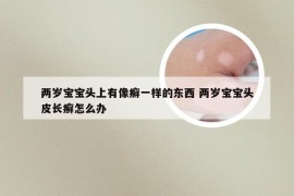 两岁宝宝头上有像癣一样的东西 两岁宝宝头皮长癣怎么办