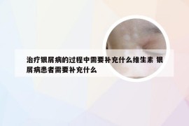 治疗银屑病的过程中需要补充什么维生素 银屑病患者需要补充什么