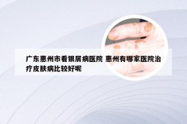 广东惠州市看银屑病医院 惠州有哪家医院治疗皮肤病比较好呢