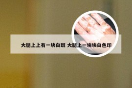 大腿上上有一块白斑 大腿上一块块白色印