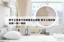 脖子上有多个白斑是怎么回事 脖子上有好多白斑一块一块的