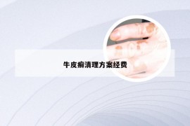 牛皮癣清理方案经费