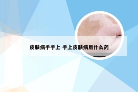 皮肤病手手上 手上皮肤病用什么药