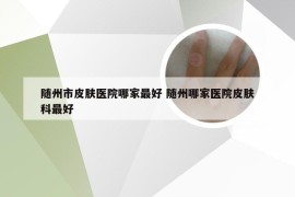 随州市皮肤医院哪家最好 随州哪家医院皮肤科最好