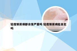 轻度银屑病都会变严重吗 轻度银屑病能自愈吗