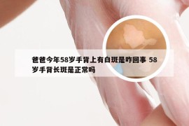 爸爸今年58岁手背上有白斑是咋回事 58岁手背长斑是正常吗