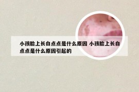 小孩脸上长白点点是什么原因 小孩脸上长白点点是什么原因引起的