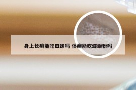 身上长癣能吃田螺吗 体癣能吃螺蛳粉吗