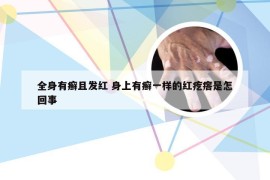 全身有癣且发红 身上有癣一样的红疙瘩是怎回事