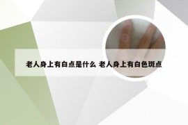 老人身上有白点是什么 老人身上有白色斑点