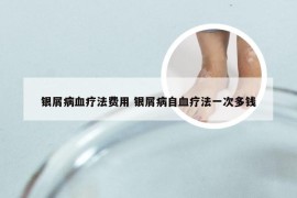 银屑病血疗法费用 银屑病自血疗法一次多钱