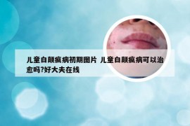 儿童白颠疯病初期图片 儿童白颠疯病可以治愈吗?好大夫在线