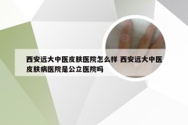 西安远大中医皮肤医院怎么样 西安远大中医皮肤病医院是公立医院吗