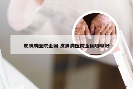 皮肤病医院全国 皮肤病医院全国哪家好