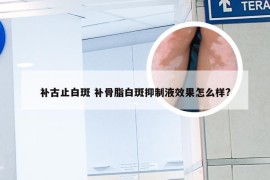 补古止白斑 补骨脂白斑抑制液效果怎么样?