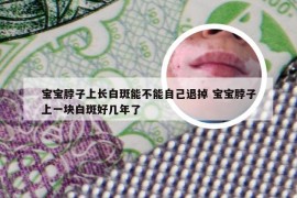 宝宝脖子上长白斑能不能自己退掉 宝宝脖子上一块白斑好几年了