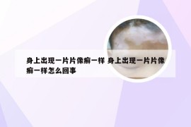 身上出现一片片像癣一样 身上出现一片片像癣一样怎么回事