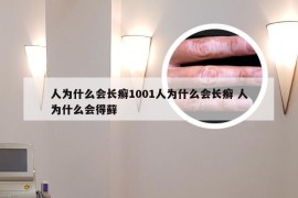 人为什么会长癣1001人为什么会长癣 人为什么会得藓