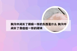 胸沟中间长了跟癣一样的东西是什么 胸沟中间长了像痘痘一样的硬块