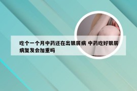 吃个一个月中药还在出银屑病 中药吃好银屑病复发会加重吗