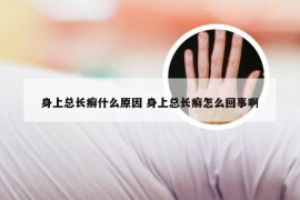 身上总长癣什么原因 身上总长癣怎么回事啊