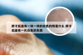 脖子后面有一块一块的白色的斑是什么 脖子后面有一片白色的东西