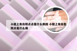 小腿上有白斑点点是什么原因 小腿上有白色斑点是什么病