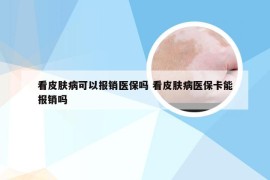 看皮肤病可以报销医保吗 看皮肤病医保卡能报销吗