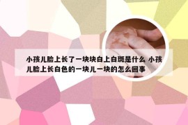 小孩儿脸上长了一块块白上白斑是什么 小孩儿脸上长白色的一块儿一块的怎么回事