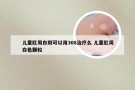 儿童肛周白斑可以用308治疗么 儿童肛周白色颗粒