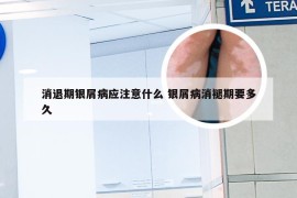 消退期银屑病应注意什么 银屑病消褪期要多久