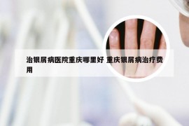 治银屑病医院重庆哪里好 重庆银屑病治疗费用