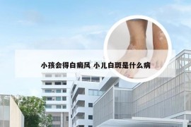 小孩会得白癜风 小儿白斑是什么病