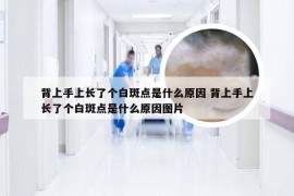 背上手上长了个白斑点是什么原因 背上手上长了个白斑点是什么原因图片