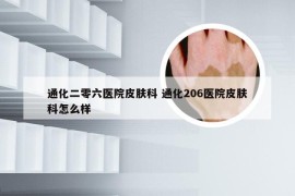 通化二零六医院皮肤科 通化206医院皮肤科怎么样