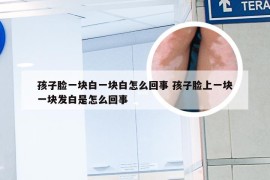 孩子脸一块白一块白怎么回事 孩子脸上一块一块发白是怎么回事