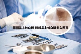 麒麟掌上长白斑 麒麟掌上长白斑怎么回事