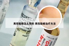 男性股癣怎么得的 男性股癣治疗方法