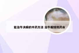 能治牛决癣的中药方法 治牛癣特效药水