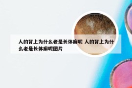 人的背上为什么老是长体癣呢 人的背上为什么老是长体癣呢图片