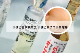 小便上面长的白斑 小便上长了个小白疙瘩