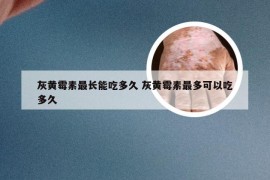 灰黄霉素最长能吃多久 灰黄霉素最多可以吃多久